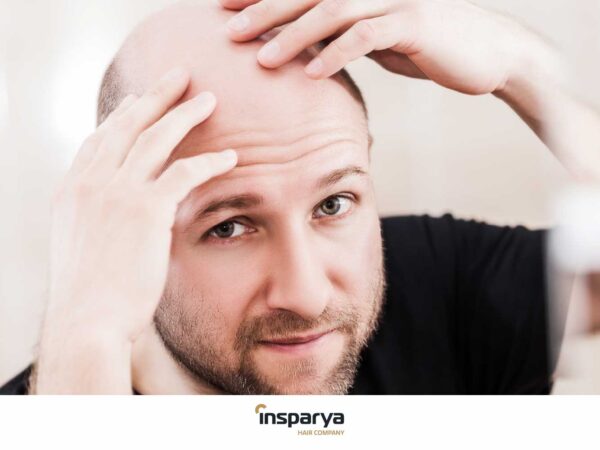 Esiste una relazione tra alopecia e salute orale?