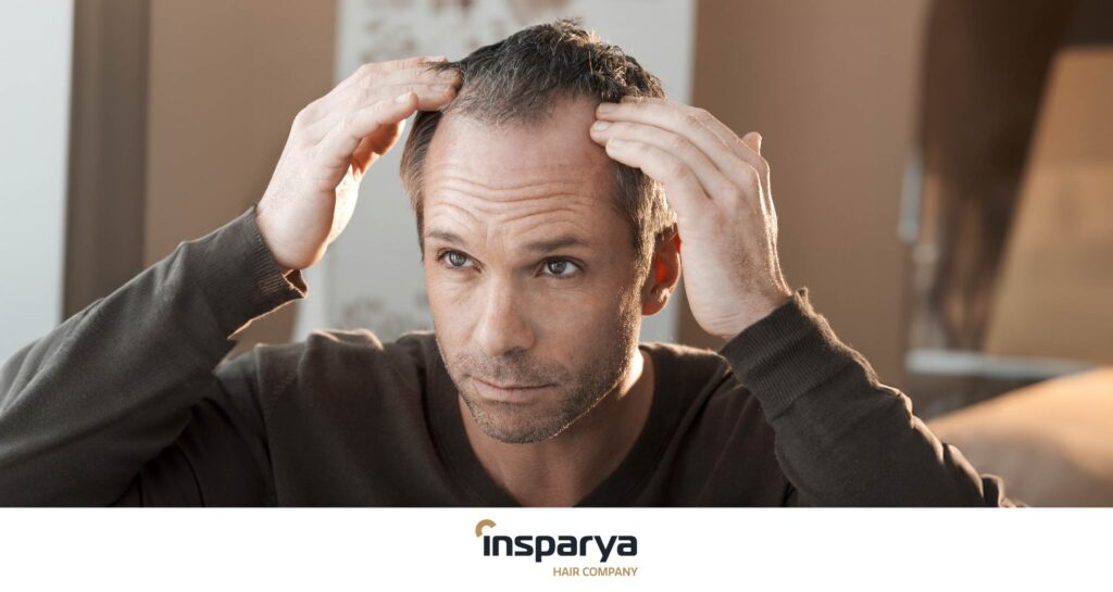 Alopecia a 40 anni trattamenti per recuperare la propria autostima