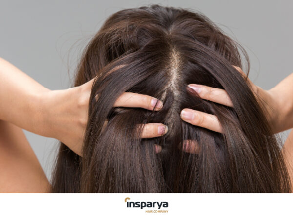 Diradamento Capelli: Cause Principali 
