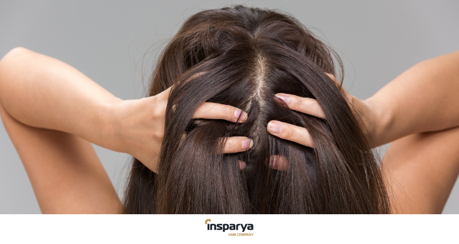 Diradamento Capelli: Cause Principali