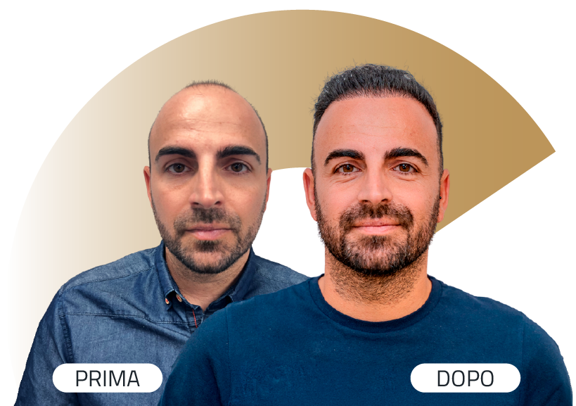 Insparya Prima / Dopo