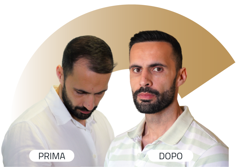 Insparya Prima / Dopo